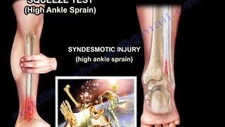 Ankle examination ,ankle sprain ,ankle pain - Everything You Need To Know - Dr. Nabil Ebraheim