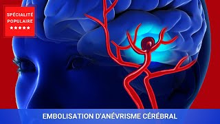 Embolisation Danévrisme Cérébral