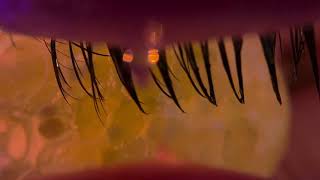 ASMR EYE CLEANING WITH ORBIZ 👁️🌕 screenshot 5