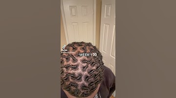 Starter Loc Journey. comment good organic products #dreadlocks #locjourney #locstyles #starterlocs