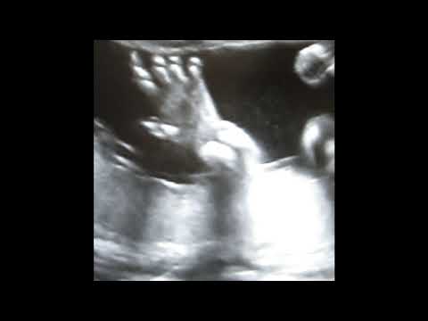 Traumprinz - Light Flooded [APW-5]