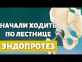 Ходьба после эндопротезирования тазобедренного сустава