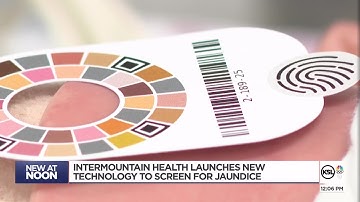 Intermountain Health is testing new technology to screen for jaundice
