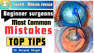 Common mistake by beginner surgeons during Rhexis rescue manoeuvres (My top tips) Part- 01