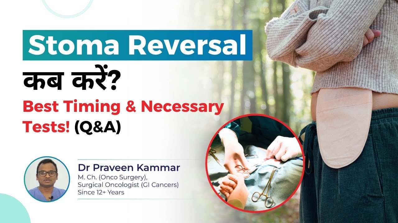 Stoma Reversal Surgery: Best Timing and Key Factors to Consider! | Dr Praveen Kammar, Mumbai