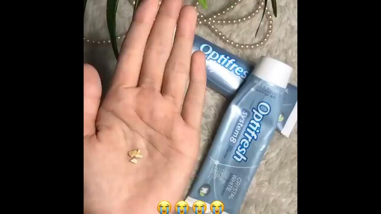 RONTOKKAN KARANG GIGI PAKE PASTA GIGI OPTIFRESH ORIFLAME RONTOKKAN KARANG GIGI PAKE PASTA GIGI OPTIFRESH ORIFLAME