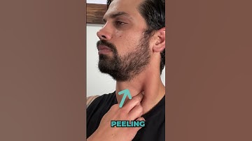 The BEST Self Massage Routine For The Sternocleidomastoid