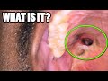 Black Hole In My Mouth?  Two Mystery Cases - What Are They?