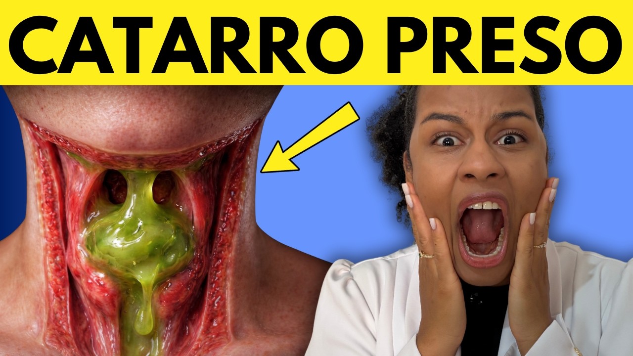 Elimine agora o CATARRO TÓXIC0 acumulado na GARGANTA