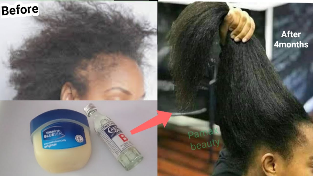 How to use Vaseline & Castor oil to grow hair 2 cm per day very fast ||  Grow hair longer in 2 weeks - YouTube