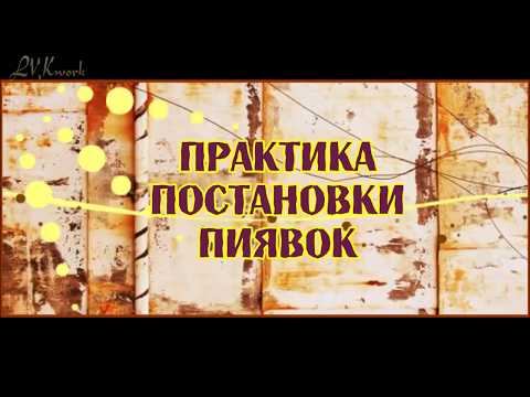 Практика постановки пиявок