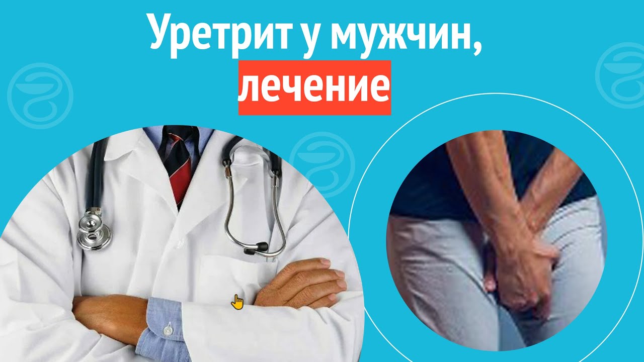 💊 Уретрит у мужчин, лечение. Клинический случай №1200 - YouTube