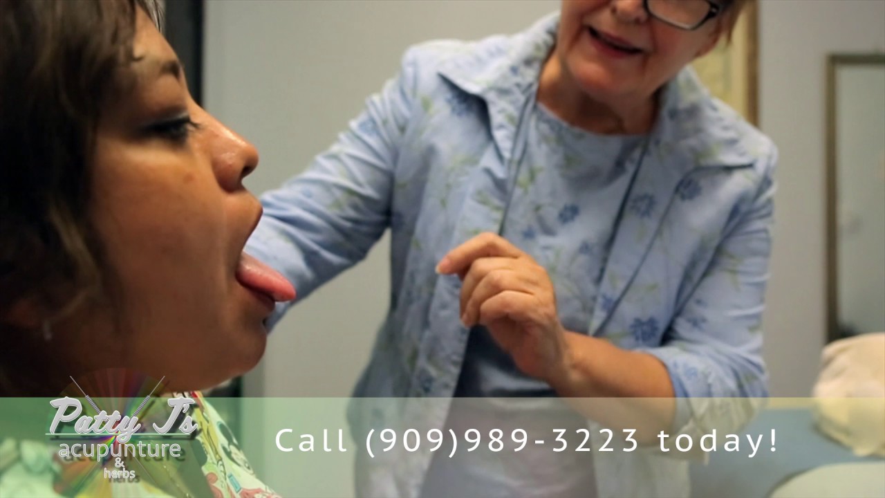 Patty Johnson's Acupuncture in Rancho Cucamonga YouTube