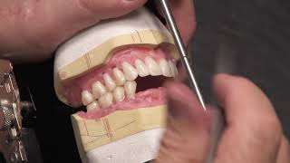 Setting Artic Teeth