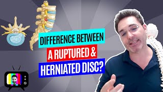 28.What is the difference between a ruptured and herniated disc?