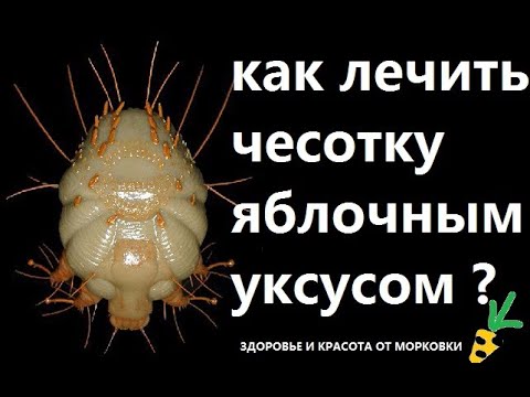 как лечить чесотку яблочным уксусом и лимонами?