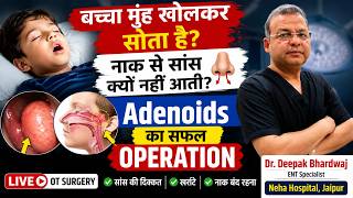 LIVE Adenoid Surgery in OT | बच्चों में Adenoids का ऑपरेशन कैसे होता है? Adenoids का सफल Operation