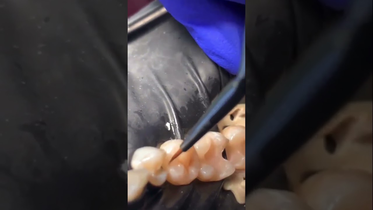 Adding colour to restoration 