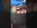 The toenails are both yellow and transparent; the trimming process is amazing! #satisfying #nails