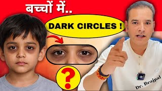 DARK CIRCLES IN KIDS 👉 CAUSES, MYTHS & SOLUTIONS BY DR BRAJPAL