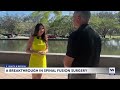 Naples doctor makes breakthrough in spinal fusion surgery