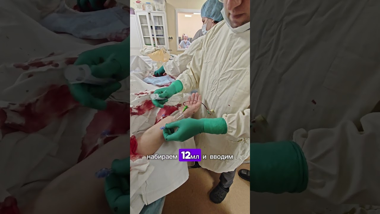 Цивилизованный гемостаз браслетом Ньюмен после стентирования артерий сердца #доктор #врачипоют