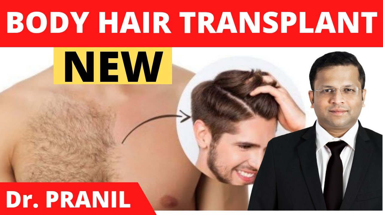 Body Hair Transplant (BHT) Fully Explained || Chest Hair Transplant Results  - YouTube
