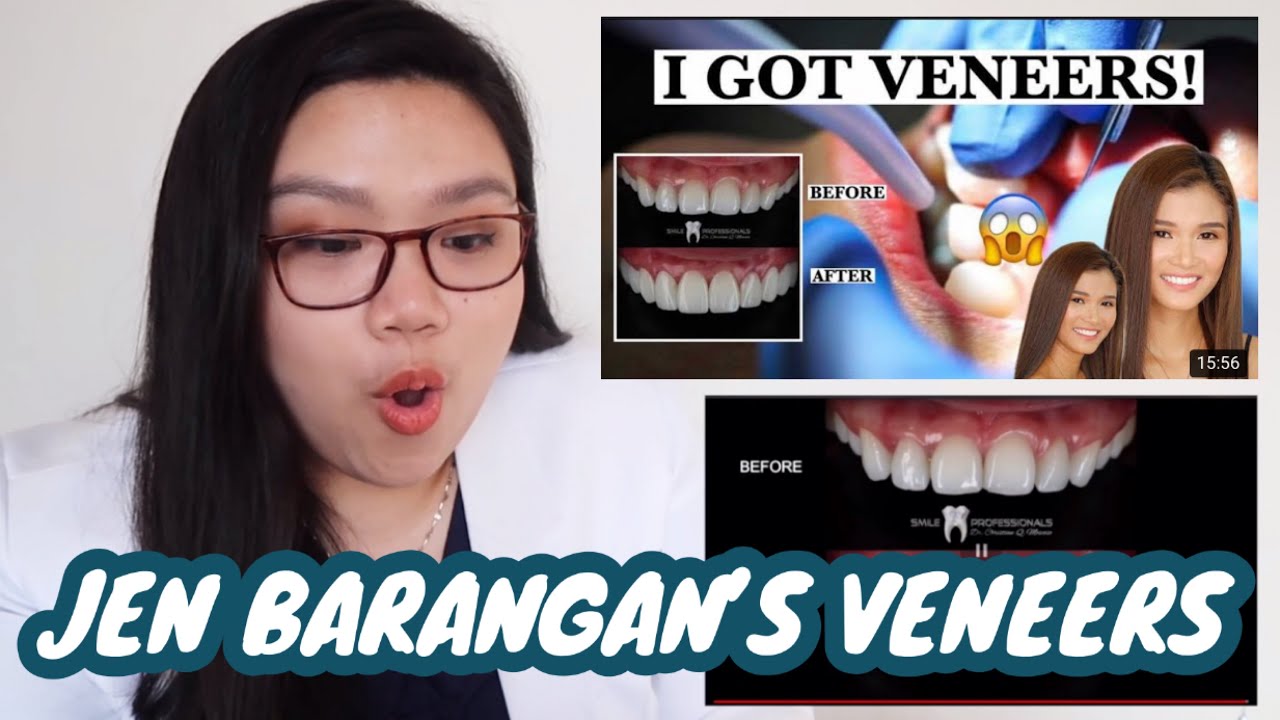 REACTION VIDEO: JEN BARANGAN'S VENEERS AND GUM LIFT PROCEDURE 🦷 | Dr