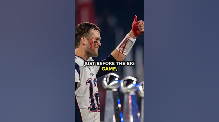 🏆✂️ "Tom Brady’s Super Bowl Scissor Accident 😱🏈"