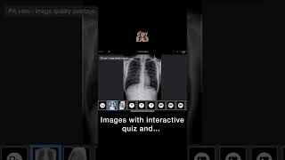 Dr. Devpriyo Pal (@DrDevRad) reviewing our app on Instagram #radiology screenshot 4