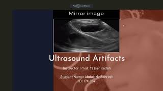 Ultrasound Artifacts - Abdulaziz Bahresh