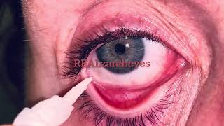 Removing waterproof EYEMAKE UP and WHITE CLAY MASK