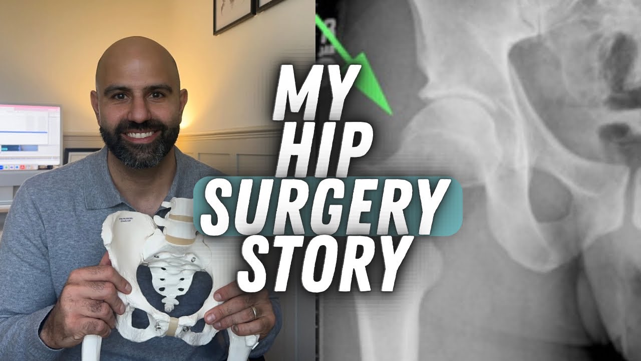 MY HIP IMPINGEMENT (FAI) SURGERY STORY & RECOVERY / RESULTS