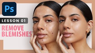 Remove Blemishes  Photoshop Retouching Course | Lesson 1