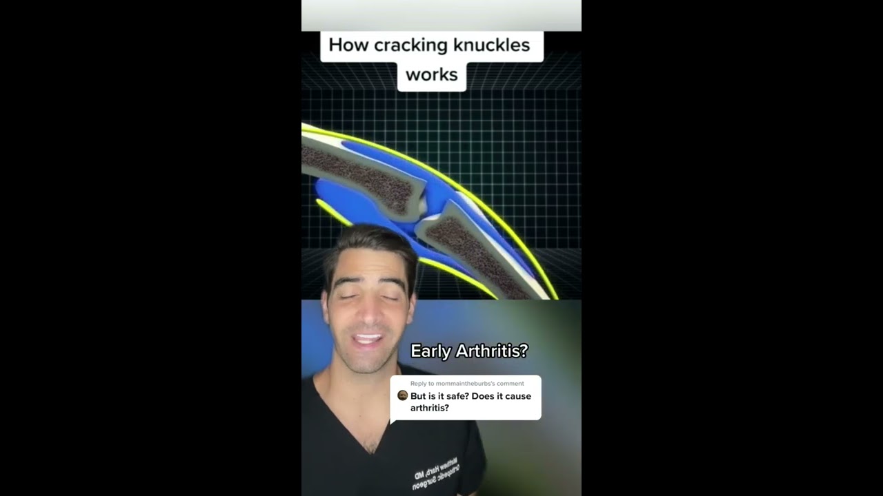Does Cracking Joints Cause Arthritis 