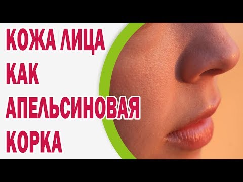 Кожа лица как апельсиновая корка: как быть?