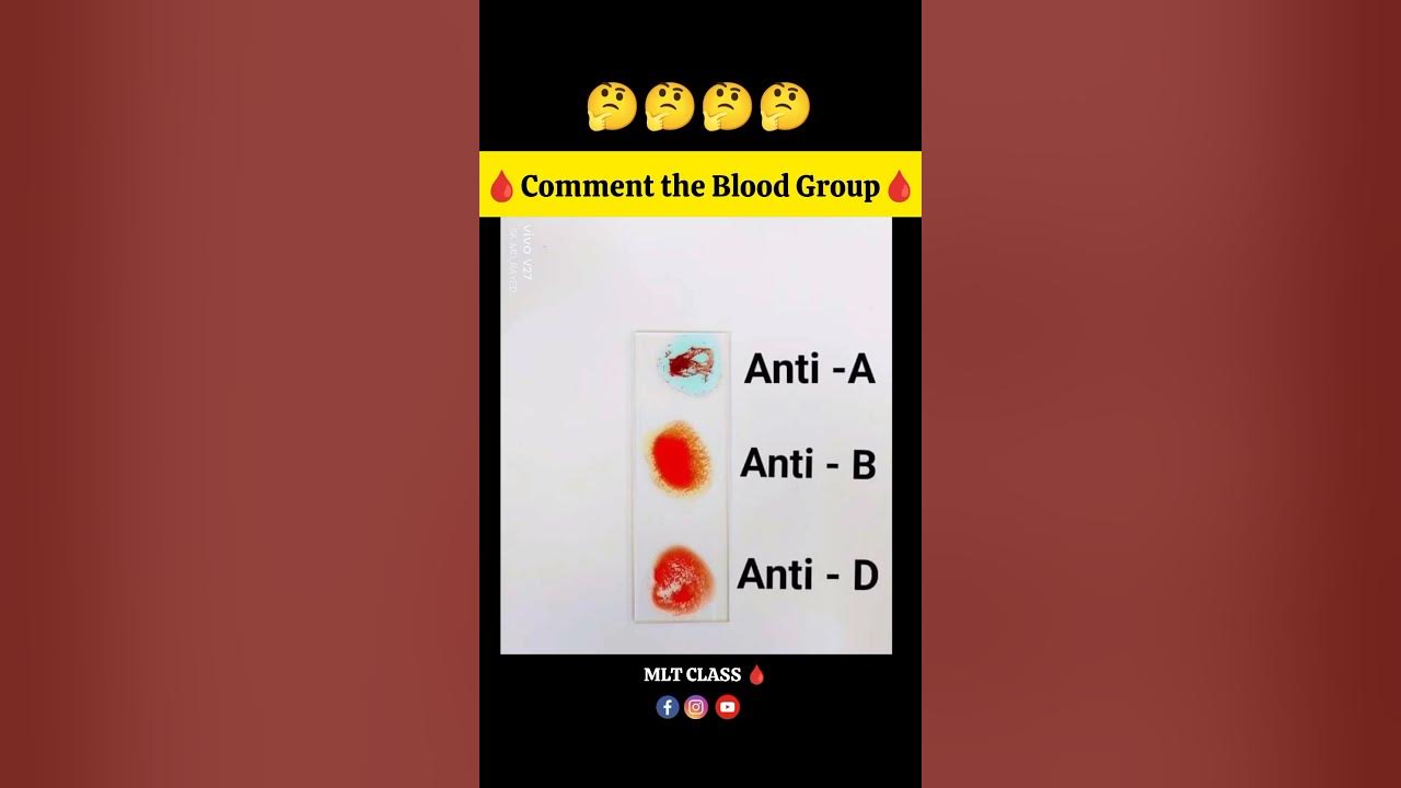 what-is-the-blood-group-shorts-viral-trending-bloodgroup