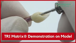 Forever Green Tri Matrix Implant Demonstration On 41 Model And Actual Size Model