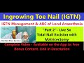 How to do total nail excision with matricectomy teaser igtn management part 2 ingrowingnail