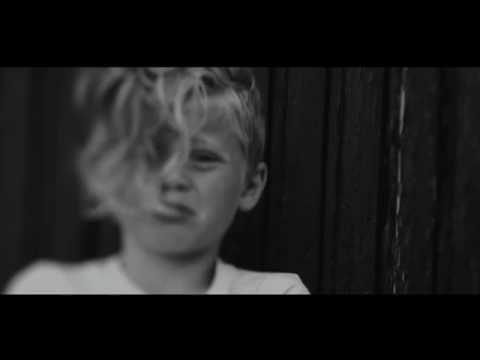 Albino Video