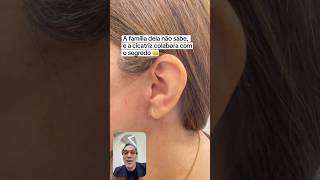 Rejuvenescimento tão bonito e discreto que dá até pra guardar segredo 🤐 #facelift