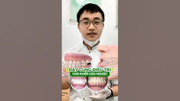 Dây cung điều trị cho bệnh nhân khớp cắn ngược khác biệt thế nào? #niengrang #nhakhoagreenlife