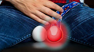 Come capire di avere un tumore ai testicoli?