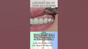 Chỉ Trong 30 Ngày, Bọc Răng Sứ Thẩm Mỹ Sẽ Thay Đổi Nụ Cười Của Bạn!