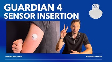 Medtronic Guardian 4 sensor insertion - How to Insert The Guardian 4 sensor
