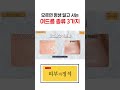 모르면 평생 달고 사는 여드름 종류 3가지