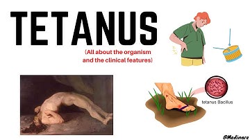 Tetanus | Part 1 | In just 10 minutes | Medinare