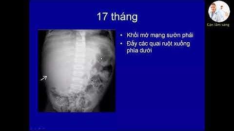 Đánh giá hoại tử tế bào gan