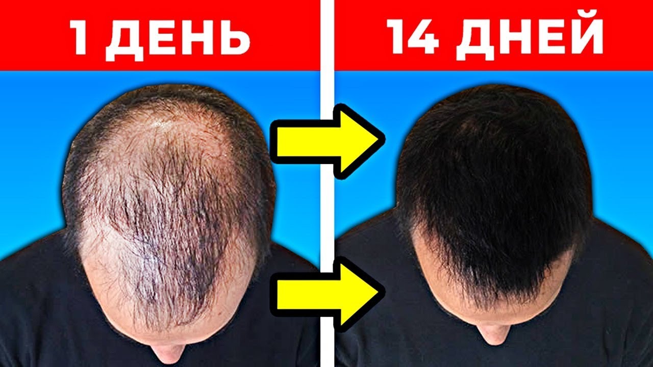 10 Способов Как Быстро Отрастить Волосы - YouTube