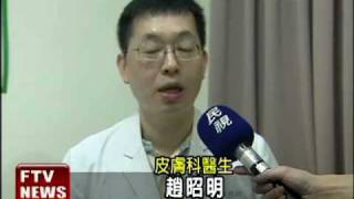 濕紙巾擦汗 恐引發皮膚發炎－民視新聞